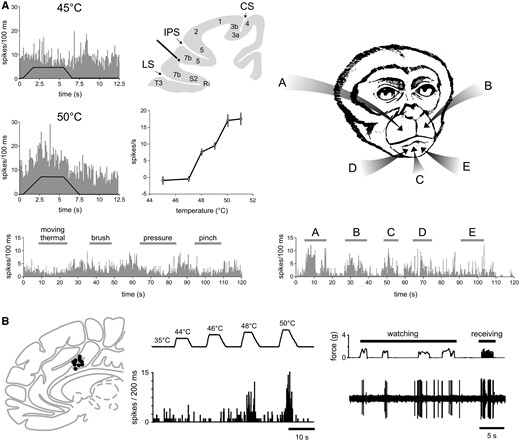 Assessing the selectivity for pain of a given brain response requires not only to demonstrate that the response is present when pain is experienced, but also to demonstrate that it is not present when pain is not experienced. (A) Dong et al. (1994) recorded the activity of a single neuron located in area 7b, close to the secondary somatosensory cortex. When tested with a variety of thermal and mechanical somatic stimuli, the neuron responds to noxious heat stimuli applied to the face in a graded fashion, whereas it does not respond to a variety of mechanical stimuli. Based on these observations one might be tempted to conclude that the neuron is specific for burning pain. However, the same neuron also responds vigorously to visual stimuli approaching its receptive field (A–E), and the response was most prominent when the approaching object was novel or threatening. Therefore, in classical pain studies testing the response properties with noxious and innocuous somatosensory stimuli, this neuron would be labelled as nociceptive-specific (NS). However, this labelling would be incorrect, at least until the lack of responses to a wide range of equally salient, unpleasant and behaviourally-relevant stimuli has been comprehensively demonstrated. (B) Similarly, Hutchison et al. (1999) performed single unit recordings in the human anterior cingulate cortex, and found many neurons responding to noxious heat stimuli, and not to slow-rising innocuous mechanical stimuli. However, some of these neurons also responded to watching noxious stimuli being delivered to the experimenter, suggesting that they may serve a supramodal function related or consequent to stimulus saliency or threat detection. CS = central sulcus; IPS = intraparietal sulcus; LS = lateral sulcus. Adapted with permission from Fig. 7 in Dong et al. (1994) and Fig. 1 in Hutchison et al. (1999).