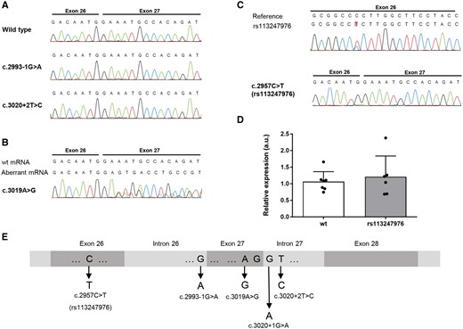 Sequencing and qPCR analysis of mRNA of lymphoblast cell lines from KIF5A SNV and mutation carriers. (A) mRNA sequencing of the splice site mutations c.2993-1G>A and c.3020+2T>C shows absence of the mutated allele. (B) mRNA sequencing of the apparent missense variant c.3019A>G reveals a disruption of the splice donor site of intron 27. (C) mRNA sequencing of the SNV rs113247976 [c.2957C>T; p.(Pro986Leu)] suggests unaltered pre-mRNA splicing. (D) As analysed by quantitative PCR, heterozygous carriers of the SNV rs113247976 show equal KIF5A mRNA levels as wild-type carriers. (E) Overview of the mutational hotspot around exons 26 and 27 linked to ALS.