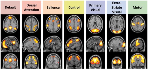 Cortical intrinsic connectivity networks chosen for analysis. These networks fall into three broad classes: Four cognitive networks (default, dorsal attention, salience, and control) thought to be involved in directed attention, memory and other aspects of cognition; two networks centred on primary and higher order visual cortices (primary visual and extrastriate visual); and a motor network including the pre-central gyrus and supplementary motor regions. Map threshold of P ≤ 0.05 (family-wise error corrected). Adapted from Schultz et al. (2014).