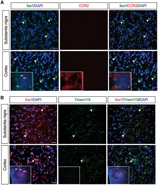 Lack of monocytes trafficking from the periphery into the brain of LPS-treated R1441G mice. (A) No CCR2 expression was seen in the substantia nigra and cortex of R1441G mice 24 h post-LPS. (B) Microglia-specific marker, Tmem119, is co-expressed in Iba1-positive microglia in the substantia nigra and cortex of R1441G mice 24 h post-LPS. Insets show spleen sections that were used as a positive and negative control for CCR2 and Tmem119 staining, respectively. Scale bar = 50 μm. Scale bar in insets = 100 μm. MZ = marginal zone; RP = red pulp; WP = white pulp.