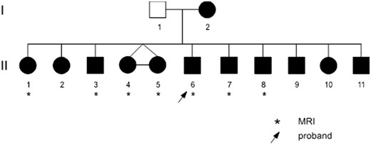Family pedigree. Individuals in black have CAS errors (see Supplementary Table 2 for details).