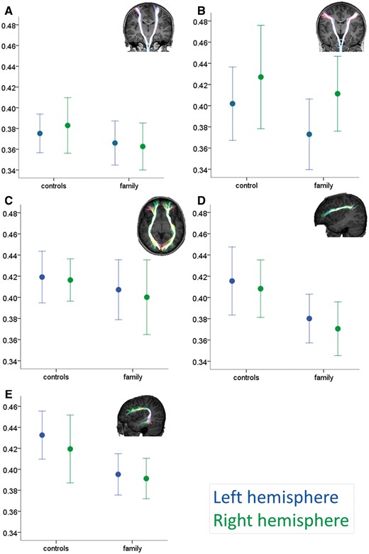 White matter differences between the family and control group. Group values (mean ± 1 SD) for mean fractional anisotropy within the motor tracts (A, hand-related corticospinal; B, speech-related corticobulbar), the ventral language-related tract (C, inferior fronto-occipital fasciculus or IFOF) and dorsal language-related tracts (D, arcuate anterior segment and E, arcuate direct segment). Insets: Examples of tractography output superimposed onto a control participant’s T1-weighted dataset. Tracts are projected onto each slice to allow visualization of full length. See Supplementary Fig. 2 for a scatterplot of the relationship between age and fractional anisotropy in the IFOF and corticospinal tracts.