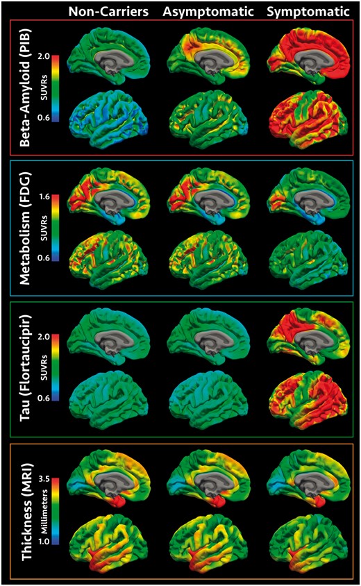 Visualization of pathology across the cohort. Spatial renderings in mutation non-carriers, asymptomatic mutation carriers, and symptomatic mutation carriers for amyloid-β deposition measured with PiB PET, glucose metabolism measured with FDG PET, neurofibrillary tau pathology measured with AV1451, and cortical thickness measured with MRI. PET values represent SUVRs relative to the cerebellar cortex and cortical thickness values are in millimetres. For convenience, data are shown for the inflated left hemisphere.