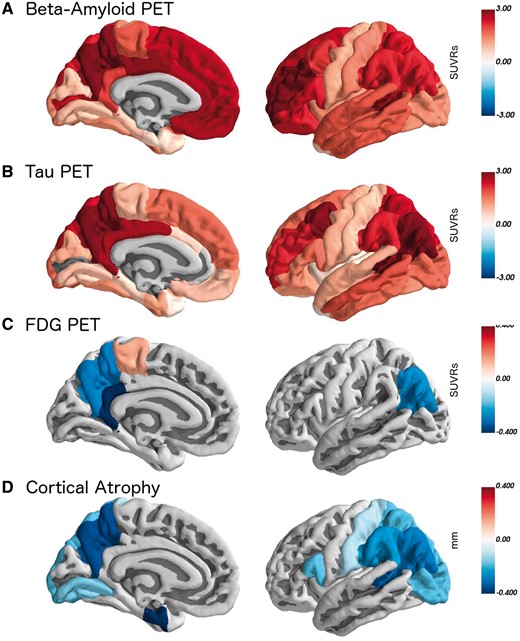 All regions where pathology was significantly different in symptomatic mutation carriers relative to non-carriers. The colour scale represents the difference between groups in the units of that measurement (SUVRs for PET, and mm for thickness). Data were for the averaged left and right regions of interest, but are presented here on the left hemisphere for visualization.