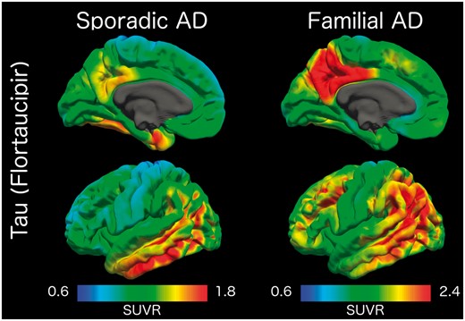 Comparison of tau PET binding in symptomatic mutation carriers (left) and older adults with sporadic Alzheimer’s disease (right) with cognitive impairment. Values represent SUVRs relative to the cerebellar cortex. AD = Alzheimer’s disease.