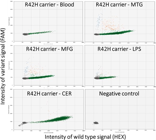 Allelic discrimination plots of the digital droplet PCR for the R42H TARDBP somatic variant. Each marker represents a single droplet and its respective wild-type (horizontal axis) and variant (vertical axis) signal intensity. Five different tissues of the carrier were tested: blood, middle temporal gyrus (MTG), middle frontal gyrus (MFG), lateral parietal lobe (LPS), cerebellum (CER) and a negative control of water is shown. The grey droplets are considered empty, green droplets are wild-type only, orange is both wild-type and variant alleles, and blue droplets were harbouring only the variant allele.