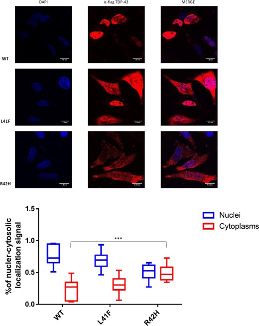 Impact of TARDBP variants on the localization of flagged-TDP-43 wild-type and mutant proteins overexpressed in HeLa cells. The overexpressed proteins were visualized using anti-Flag polyclonal antibody in a 100 nm/pixel field. Scale bar = 10 nm. Top row: Wild-type Flag TDP-43, followed by Flagged TDP-43s carrying both variants; L41F and R42H. Left column: DAPI staining to indicate the chromatin in the nucleus in blue. Middle column: TDP-43 stained in red with a Flag-specific antibody. Right column: Merged images demonstrating TDP-43 localization in the nucleus for wild-type TDP-43, whilst localizing also in the cytoplasm for both TDP43 with variant R42H and L41F. Bottom: Box plots showing fluorescent TDP-43 signal is quantified in the nucleus and cytoplasm for nine cells of each line. The average ratio of nuclear and cytosolic signal is plotted and compared between groups. ****P < 0.0001 and ***P < 0.001 as calculated by two-way ANOVAs between the groups illustrated.