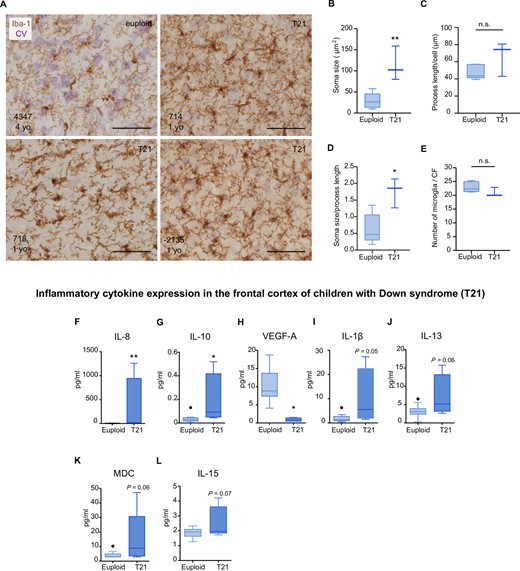 Microglial morphological changes and increased inflammatory cytokine expression in the frontal cortex of children with Down syndrome. Top: (A–E) Microglial cells from children (1–10 years) were detected by immunohistochemistry against the monocytic marker Iba-1 (brown). Cresyl violet (CV) staining was used to identify cortical laminae. (A) Representative micrographs of control (euploid) and Down syndrome (T21) cases (1–10 years old). Control microglia displayed thin and ramified processes which are indicative of a physiological surveying state. Down syndrome microglia displayed a reactive phenotype reflective of intermediate activation. (B) Microglia from children with Down syndrome displayed an increase in soma size, t(6) = 4.15, P = 0.006. (C) Microglial process length did not differ between control and Down syndrome cases, t(6) = 1.82, P = 0.11. (D) An increase in the soma size-to-cell ratio was found in children with Down syndrome compared to controls, t(6) = 3.40, P = 0.01. (E) No significant differences were found in the number of microglia in children with Down syndrome compared to controls, t(6) = 1.50; P = 0.18. Euploid n = 6, T21 n = 3. Bottom: Increased levels (pg/ml) of (F) IL-8 (U = 0, P = 0.002) and (G) IL-10 (U = 4, P = 0.03) and decreased levels of (H) VEGF-A, t(12) = 3.764, P = 0.002, were observed in the frontal cortex of children with Down syndrome (1–13 years old), as examined by a multiplex protein electrochemiluminescent assay. A trend towards an increase of (I) IL-1β; U = 6; P = 0.05 (J) IL-13; t(12) = 2.02, P = 0.06; (K) MDC; U = 9, P = 0.06 and (L) IL-15; t(13) = 1.97, P = 0.07, was also noted in the Down syndrome group. Euploid n = 10, T21 n = 5. (B–G, I and K) Two-tailed Mann-Whitney test and (H, J and L), two-tailed unpaired Student's t-test. Data are displayed in box plots where the box represents the interquartile interval in which the upper and bottom ends of the box represent the third and the first quartile, respectively. The horizontal line in the box represents the median. The vertical lines or whiskers extending from the box represent the minimum and maximum values in the dataset. Full circles represent outliers according to Tukey’s rule. Scale bar = 50 μm. *P < 0.05, **P < 0.01. n.s. = not significant.