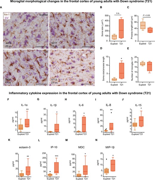 The frontal cortex of young adults with Down syndrome displays an exacerbated inflammatory profile. Top: (A) Microglial cells from young individuals (15–25 years old) as revealed by immunohistochemistry against Iba-1 and cresyl violet (CV) counterstain. (B) Microglial soma size did not differ between Down syndrome and control groups, t(8) = 1.843, P = 0.10; however, half of Down syndrome cases displayed an increase in soma size. (C) A trend towards a smaller process length was observed in young individuals with Down syndrome compared to controls, t(8) = 2.23, P = 0.05. (D) Young adults with Down syndrome display an increase in their soma size-to-process length ratio, t(8) = 2.373, P = 0.04. (E) The number of microglial cells remained unchanged at this age, t(8) = 0.94, P = 0.37). CF = counting frame. Euploid n = 7, T21 n = 4. Bottom: Multiplex protein electrochemiluminescent assays revealed that young adults with Down syndrome (13–27 years old) display an upregulation of inflammatory markers (pg/ml) before the development of a full-blown Alzheimer’s disease pathology (F–N). (F) U = 29, P = 0.03; (G) U = 24, P = 0.01; (H) U = 25, P = 0.02; (I) t(24) = 3.13, P = 0.004; (J) t(27) = 2.49, P = 0.01; (K) t(28) = 3.22, P = 0.003; (L) t(27) = 4.51, P = 0.0001, (M) U = 25, P = 0.01; (N) U = 25, P = 0.02. Euploid n = 24, T21 n = 6. (B–E and I–L) Two-tailed unpaired Student's t-test; (F–H, M and N) two-tailed Mann-Whitney test. Data are displayed in box plots where the box represents the interquartile interval in which the upper and bottom ends of the box represent the third and the first quartile, respectively. The horizontal line in the box represents the median. The vertical lines or whiskers extending from the box represent the minimum and maximum values in the dataset. Full circles represent outliers according to Tukey’s rule. Scale bar = 50 μm. *P < 0.05, **P < 0.01, ***P < 0.001. n.s. = not significant.
