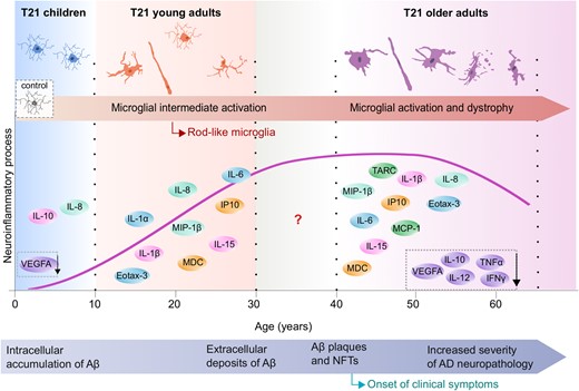 Schematic representation of the evolution of brain inflammation across the lifespan in Down syndrome. Early microglial morphological changes such as increased soma size as well as increases in rod microglia, accompanied by a heightened neuroinflammatory profile, were observed in children and young individuals with Down syndrome (as represented by the schematic illustrations), at stages when limited or no Alzheimer’s disease pathology is present. The late inflammatory process in Down syndrome is characterized by microglial activation (increased soma size, shortened processes) and an increase in dystrophic microglia and chronic neuroinflammation along with a decrease in inflammatory marker expression possibly reflecting cell exhaustion and degeneration. Aβ = amyloid-β; AD = Alzheimer’s disease; NFT = neurofibrillary tangle. Modified image from Lott and Head (2019), with permission from SpringerNature.