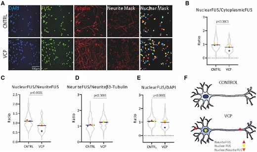 FUS is mislocalized in hiPSC-derived VCP-mutant motor neurons. (A) Subcellular localization of FUS in hiPSC-derived motor neurons with accompanying semi-automated image analysis segmentation masks for neurites, based on β-III-tubulin immunolabelling, and nuclei based on DAPI staining. (B) Quantification of FUS immunolabelling in the nucleus and the cytoplasm reveal that VCP-mutant motor neurons exhibit a decrease in FUS nuclear-to-cytoplasmic ratio. (C) Quantification of FUS in the nucleus and neurites reveal that VCP-mutant motor neurons exhibit a decrease in nuclear-to-neurite ratio of FUS. (D) FUS quantification in the neurites normalized to β-III-tubulin shows that VCP-mutant motor neurons exhibit a gain of FUS in the neurites. (E) Normalization of nuclear FUS to DAPI shows a nuclear loss of FUS in VCP-mutant motor neurons. Data are presented as ratio over control values for each experimental repeat, with each experimental repeat plotted and individual values displayed within the violin plot. Three independent control lines and four VCP-mutant lines (two clones from each of two patients) from three independent experiments were used to generate these data. P-values were calculated from an unpaired Mann-Whitney test. Intensity values were calculated using the integrated intensity divided by the area and as a background subtraction we used the lower quartile intensity per image and object. (F) Schematic diagram summarizing the mislocalization of FUS protein in VCP-mutant motor neurons.