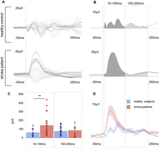 Comparison of TMS-evoked EEG potentials of the ipsilesional motor region using LMFP. (A) TMS-evoked EEG responses for one representative stroke patient and one healthy control subject are shown as butterfly plots of all channels (bold channels represent the region of interest), and (B) the corresponding LMFP with the two respective time intervals (10–100 ms; 100–200 ms). (C) For each time interval analysed, the LMFP values are shown in the bar chart for the entire group of healthy subjects and stroke patients (**P < 0.001; error bars indicate the standard error). (D) Grand-average LMFP for all stroke patients and healthy subjects. Thick traces represent the grand-average across subjects and shaded regions the standard error. Note that the dashed line indicates the timing of the TMS pulse.