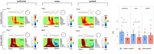 Comparison of natural frequencies using ERSP. TMS-evoked EEG responses for a representative stroke patient and one healthy control subject as butterfly plots. Red channels in the butterfly plots highlight the region of interest, i.e. prefrontal, motor, and parietal. The corresponding ERSP patterns (between 5 and 50 Hz) are shown below. Note that the red crosses indicate the region of interest for ERSP analysis and not the stimulation site, which was always the ipsilesional motor cortex. The greyscale graph plotted to the right of each ERSP reveals the power spectrum profile during 20–200 ms after TMS onset. The dotted lines indicate the frequency with maximum power, i.e. the natural frequency. The dashed line indicates the timing of the TMS pulse. The rightpanel shows a bar graph of averaged natural frequencies for each region analysed (*P < 0.05; error bars indicate the standard error).