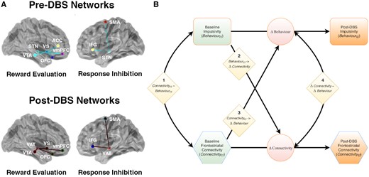 Modelling brain-behaviour covariation. (A) Two discrete networks subserving reward evaluation and response inhibition were specified based on Mosley et al. (2019a). The pre-DBS reward evaluation network was defined to include tracts connecting ventral striatum (VS) with vmPFC, OFC, anterior cingulate cortex (ACC) and VTA. It also included a tract connecting the STN with vmPFC. The response inhibition network included tracts connecting the STN with the IFG and the SMA. Postoperatively, these networks were extended to incorporate the subthalamic VAT, with a focus on connections of the VAT within the network. Network models were visualized with the BrainNet Viewer (Xia et al., 2013). (B) Cross lagged (latent change score) model which allows quantification of the relationship between preoperative structural network connectivity (Connectivityt1) and baseline measures of impulsivity (Behaviourt1) to post-DBS structural network connectivity (Connectivityt2) and postoperative measures of impulsivity (Behaviourt2). Coefficients are modelled as follows: 1, connectivity-behaviour covariance at baseline (Connectivityt1 ∼ Behaviourt1); 2, behaviour to connectivity coupling (Behaviourt1 → ΔConnectivity); 3, connectivity to behaviour coupling (Connectivityt1 → ΔBehaviour); and 4, an estimate of correlated change in connectivity and behaviour (ΔConnectivity ∼ ΔBehaviour). In the context of the present investigation, we were mainly interested in connectivity to behaviour coupling (3). Diamonds = coefficients; circles = change scores; rectangles = measured indices of impulsivity; hexagons = structural connectivity profiles. For these latter two variables, green shading indicates preoperative data and orange shading indicates postoperative data. See the main text and Supplementary material for further elaboration of these relationships. LEDD = levodopa equivalent daily dose; PCA = principal components analysis.