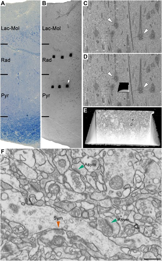 Correlative light/electron microscopy analysis of CA1 using FIB/SEM. An early-stage Alzheimer’s disease case (Case IF13, see Supplementary Table 1) is provided here as an example. (A and B) Images show a 1-µm thick semithin section stained with toluidine blue (A) adjacent to the block surface visualized with the SEM (B). This allows the exact location of the region of interest to be determined. The white arrow in B points to one of the trenches made in the neuropil (three per layer). (C) Higher magnification of B to facilitate the selection of the region of interest in the neuropil. (D) Same region as in C with a trench made to expose the tissue and to acquire the FIB/SEM stack of images. White arrowheads in C and D point out some neuronal somata. (E) Augmentation in the front of the trench allows the ultrastructural appraisal of the sample where the stack of images at the final magnification (5 nm/pixel) will be taken. (F) An example of a FIB/SEM image from a stack of serial sections. Some synapses have been marked with green (asymmetric synapses) or red arrowheads (symmetric synapses). Asym = asymmetric synapses; Lac-Mol = stratum lacunosum-moleculare; Pyr = stratum pyramidale; Rad = stratum radiatum; Sym = symmetric synapses. Scale bar in F = 335 µm in A and B; 50 µm in C and D; 6 µm in E; 750 nm in F.