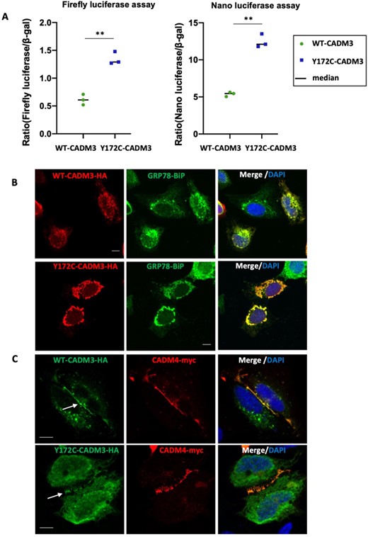 Overexpression of CADM3 mutant activates the unfolded protein response. (A) Dual reporter luciferase RT4 cells were transiently transfected with plasmids encoding the human wild‐type (WT) and mutant (Y172C) CADM3. Increased levels of firefly and nano luciferase were observed in the mutant CADM3. (B) Immunofluorescence of U2OS transfected cells shows co-localization of both wild-type and mutant CADM3 with the endoplasmic reticulum marker GPR78-BiP. (C) U2OS cells co-transfected with CADM3 and CADM4 show CADM3 co-localization with CADM4 at cell-cell contact sites.
