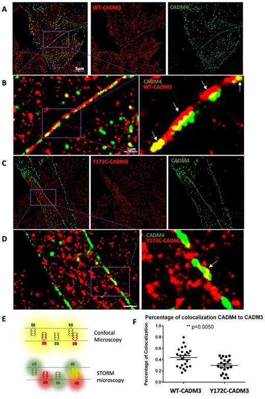 Super-resolution microscopy shows CADM3 co-localization with CADM4 at plasma membrane contact sites. (A and B) STORM imaging reveals close proximity between WT-CADM3 (red) and CADM4 (green) at cell-cell contact sites in L-cells, which lack cell-cell adhesion molecules. A representative image shows two distinct colour lines formed at cell contact sites with some co-localization overlapping between red and green. (B) Magnified views from regions demarcated by purple boxes. (C and D) Mutant Y172C-CADM3 shows less specific localization to the membrane and diminished co-localization with CADM4. (D) Magnified views from regions demarcated by purple boxes. (E) Illustration of different results obtained with conventional confocal microscopy and STORM imaging. Adjacent CADM molecules cannot be distinguished by conventional microscopy, which shows co-localization (yellow), while STORM is able to distinguish the molecules (red and green). (F) Quantification of co-localization between CADM4 and CADM3. Twenty images from each group were obtained to calculate the results (t-test, P < 0.005).