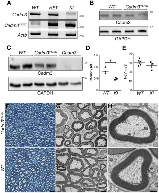 Evaluation of mouse Cadm3Y170C mutation. (A) RT-PCR analysis using wild-type and mutant-specific primers showing the presence of the wild-type and mutant CADM3 variants in the mice. (B) Western blot analysis showing the expression of CADM3 in wild-type and the knock-in homozygous mice brains. (C) Western blot of sciatic nerves isolated from the indicated genotypes using antibodies to CADM3 or GAPDH. Note the reduction in the expression of the mutant protein in sciatic nerves compared to wild-type nerves. (D) Quantification of C. (E) Mutant (knock-in) and wild-type mice show similar nerve conduction velocity. (F–H) Cadm3-Y170C mutant sciatic nerve exhibits normal myelin. (F) Toluidine blue-stained cross-sections of sciatic nerves isolated from 1.5-month-old mouse of the indicated genotype. (G and H) Electron microscopy images of sciatic nerves showing normal myelin morphology in wild-type (WT) and mutant (Cadm3Y170C) nerves. Scale bars: F = 10 μm; G = 2 μm; H = 0.4 μm. *P-value = 0.01, unpaired t-test, n = 3, mean ± standard deviation (SD): wild-type 0.84 ± 0.13, knock-in 0.49 ± 0.04.