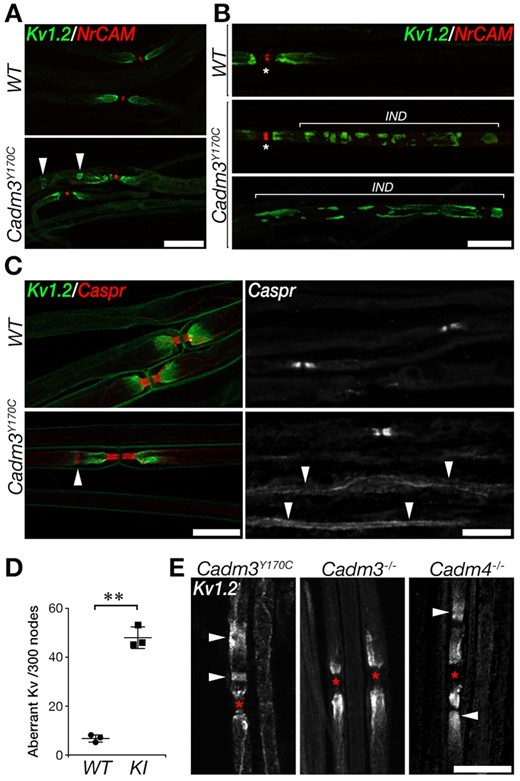 Cadm3Y170C mutant nerves exhibit abnormal axonal organization. Teased sciatic nerves were immunolabelled using antibodies to Kv1.2, NrCAM and Caspr, as indicated. (A and B) Abnormal (arrowheads) distribution of Kv1.2 potassium channels. The location of the internodes (IND) is marked in B and the nodes are marked by asterisks. (C) Mild abnormalities in Caspr (line marked by an arrowhead in lower left panel), as well as abnormal distribution of Caspr along the internodes (arrowheads in lower right panel). (D) Quantification of the number of sites containing abnormal Kv1 clusters in wild-type and mutant (knock-in) nerves. Number of sites is shown per 300 nodes; **P < 0.0001, unpaired t-test, n = 3, 300 nodes per mouse were counted, mean ± SD. (E) Kv1.2 abnormalities are present in the knock-in (left) but not in Cadm3 null mice (middle) and are similar (although less severe) than Cadm4 null mice (right). The location of the nodes is marked by asterisks. Scale bars = 20 μm (A, B, C left, D), 10 μm (C right).