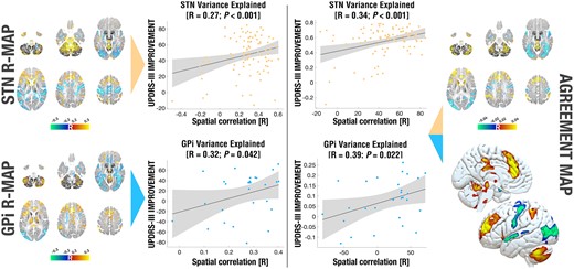 Variance in clinical outcomes explained by different models. Predictive utility of the R-map calculated in each target (left) and an agreement map, in which only regions predictive for both targets were retained (right). Using the the R-map calculated on either target alone, a significant portion of variance in outcomes in both cohorts could be explained (R = 0.27 at P < 0.001 for STN; R = 0.32 at P = 0.042 for GPi). The agreement map was able to explain additional variance in each of the two cohorts (R = 0.34 at P < 0.001 for STN; R = 0.39 at P = 0.022). Single target maps on the left correspond to renderings in Fig. 3 and are shown as volumetric cuts at z = −50, −30, −10, 10, 30 and 50 mm. The agreement map is shown both in volumetric and surface fashion. The BigBrain atlas served as the backdrop for volumetric representations.25