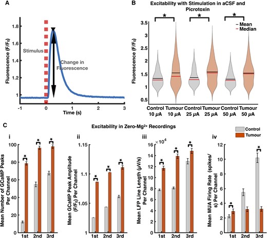 Tumour-bearing slices exhibit increased excitability compared to controls. (A) Representative local Thy1-GCaMP response (solid blue line) to microelectrode stimulation (dashed red line). (B) Violin plots displaying increased excitability in tumour-bearing slices. The mean GCaMP peak amplitude (F/F0) at electrodes which demonstrated a response at 10 μA, 25 μA, and 50 μA was 1.55 ± 0.04, 1.58 ± 0.03, and 1.54 ± 0.03 in tumour-bearing slices and 1.33 ± 0.03, 1.36 ± 0.02, and 1.30 ± 0.02 in controls (10 μA control: n = 79,10 μA tumour: n = 135, 25 μA control: n = 226, 25 μA tumour: n = 274, 50 μA control: n = 255, 50 μA tumour: n = 280, P < 0.01 in each, Mann–Whitney U-test, two-tailed). (C) Tumour-bearing slices were more excitable than controls with respect to mean number of GCaMP peaks per channel (i), mean GCaMP peak amplitude per channel (ii), and mean LFP line length per channel (iii) (control: n = 480, tumour: n = 883, P < 0.01 for each analysis in each period, Mann–Whitney U-test, two-tailed). The MUA firing rates (control: n = 480, tumour: n = 883, P < 0.01 in first period, P = 0.67 in second period, P < 0.01 in third period, Mann–Whitney U-test, two-tailed) (iv) were discordant with these results.