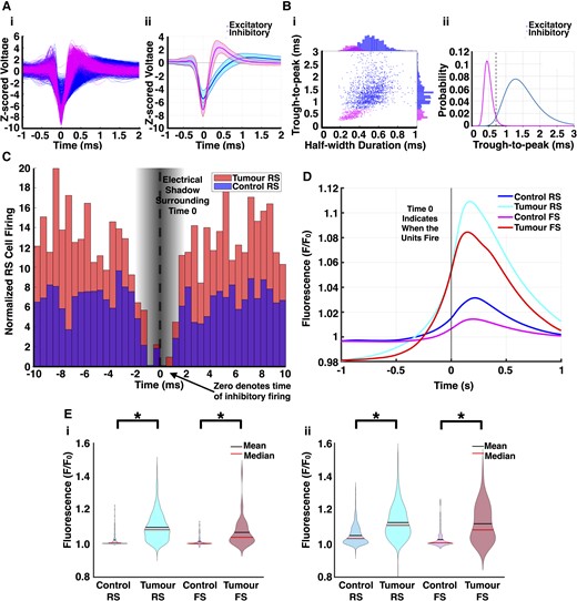 Single unit analysis demonstrates decreased inhibitory detection with dysfunctional inhibitory firing in glioma-infiltrated cortex. (A) Waveforms of all putative RS cells (blue) and FS cells (magenta) (i) after subclassification with average waveform (ii) of both groups. Shading represents SD. (B) Trough-to-peak and half-width maximum were the two parameters chosen to describe spike waveforms. Each cell's average waveform is represented in the 2D space of the two parameters with outliers excluded (i). A bimodal distribution was evident in the trough-to-peak data, and a Gaussian mixture model was fitted to find the intersection point (0.7165 ms, dashed line) between the two components (ii). (C) Average of all cross-correlograms constructed for pairs of RS cells and FS cells sorted from the same channel. Time 0 indicates FS cell firing, while bars represent RS cell firing from −10 to 10 ms. Because of the nature of spike detection, the values of the cross-correlograms from −1.5 to 1.5 ms are thus artificially reduced. While the firing rates of FS cells were decreased in tumour-bearing slices, their activity was more concentrated within periods of increased pyramidal cell firing (control: n = 602 pairs, tumour: n = 92 pairs, P < 0.01, Mann–Whitney U-test, two-tailed). (D) Mean STA GCaMP signals of each cell type in tumour-bearing slices and controls. Time 0 indicates when units fired. (E) Violin plots depicting the maximum amplitude of the STA GCaMP signals from 0 to 200 ms by cell type. In the first half of the recording (i), the median RS cell STA GCaMP signal amplitude (F/F0) was 1.08 in tumour-bearing slices versus 1.01 in controls (control: n = 350, tumour: n = 768, P < 0.01, Mann–Whitney U-test, two-tailed); the median FS cell STA GCaMP signal amplitude (F/F0) was 1.04 in tumour-bearing slices versus 1.00 in controls (control: n = 204, tumour: n = 41, P < 0.01, Mann–Whitney U-test, two-tailed). In the second half of the recording (ii), the median RS cell STA GCaMP signal amplitude (F/F0) was 1.08 in tumour-bearing slices versus 1.03 in controls (control: n = 376, tumour: n = 784, P < 0.01, Mann–Whitney U-test, two-tailed); the median FS cell STA GCaMP signal amplitude (F/F0) was 1.11 in tumour-bearing slices versus 1.00 in controls (control: n = 204, tumour: n = 43, P < 0.01, Mann–Whitney U-test, two-tailed).