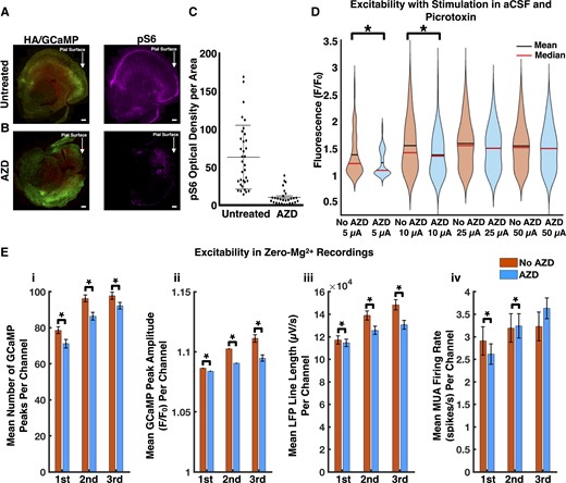 mTOR inhibition decreases excitability within glioma-infiltrated cortex. Low power immunofluorescence micrographs of untreated (A) and treated (B) tumour-bearing slices, demonstrating decreased mTOR signalling in neuronal and neoplastic cells of treated slices. This was evidenced by reduced levels of phosphorylated S6 ribosomal protein (untreated: n = 34, treated: n = 27, P < 0.01, unpaired t-test, two-tailed) (C). (D) Violin plots displaying decreased excitability in treated tumour-bearing slices. The mean amplitudes of the local GCaMP response (F/F0) at 5 μA was 1.37 ± 0.04 in untreated slices versus 1.23 ± 0.03 in treated ones (5 μA untreated tumour: n = 102, 5 μA treated tumour: n = 53, P < 0.05, Mann–Whitney U-test, two-tailed); at 10 μA it was 1.55 ± 0.04 in untreated slices versus 1.37 ± 0.04 in treated ones (10 μA untreated tumour: n = 135, 10 μA treated tumour: n = 116, P < 0.01, Mann–Whitney U-test, two-tailed). (E) Excitability was decreased in treated tumour-bearing slices with respect to mean number of GCaMP peaks per channel (i), mean GCaMP peak amplitude per channel (ii) and mean LFP line length per channel (iii) (untreated tumour: n = 883, treated tumour: n = 916, P < 0.01 for each analysis in each period, Mann–Whitney U-test, two-tailed). The MUA firing rates (untreated tumour: n = 883, treated tumour: n = 916, P < 0.05 in first period, P < 0.01 in second period, P = 0.12 in third period, Mann–Whitney U-test, two-tailed) (iv) were discordant with these results. Scale bars = 400 µm (A), 400 µm (B).