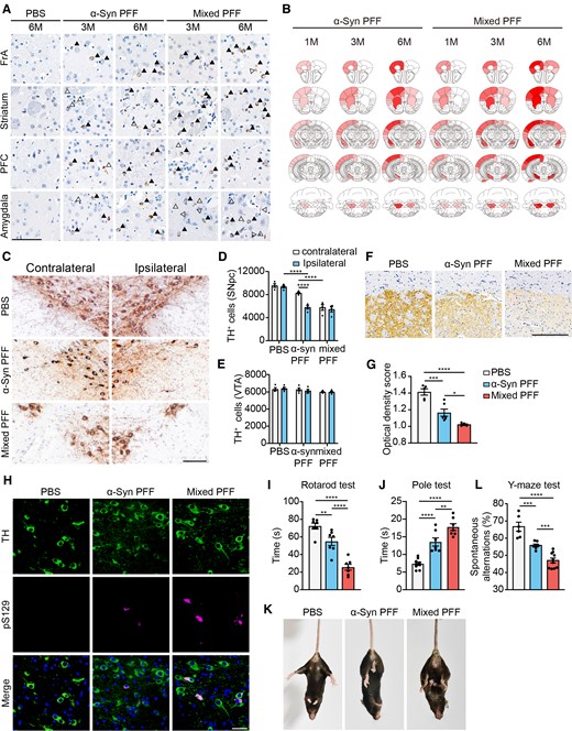 Tau–α-syn mixed PFFs show enhanced seeding activity in vivo. (A) Representative images of α-syn pathology in mice injected with either α-syn PFFs or mixed PFFs at 3 and 6 mpi. Arrowheads indicate Lewy bodies and open arrowheads indicate Lewy neuritis revealed by immunostaining with anti-pS129 antibody. Scale bar = 20 μm. (B) Heat maps of semiquantitative pS129-pathological scores across regions in mice injected with α-syn PFFs and mixed PFFs. The increase in α-syn pathology is reflected by the colour change from white to red (n = 7–10 mice per group). (C) Representative TH staining of SN dopaminergic neurons in wild-type mice injected with different PFFs at 6 mpi. Scale bar = 20 μm. (D and E) Dopaminergic neuron counting in contralateral and ipsilateral SNpc (D) and ventral tegmental area (VTA) (E). (F) Representative immunostaining of TH in the ipsilateral striatum. Scale bar = 200 μm. (G) Quantitation of the average optical densities of dopaminergic terminals. (H) Double-labelling immunofluorescence of TH (green) and pS129 (magenta) of SN dopaminergic neurons in brain slices of mice injected with different PFFs at 6 mpi. Scale bar = 20 μm. (I and J) Rotarod test results (I) and pole test (J) were performed 6 mpi in mice injected with different PFFs. (K) Representative images of tail suspension test presenting clasping arms and legs of the mice injected with different PFFs. (L) Y-maze test showing impaired short-term memory in mice injected with mixed PFFs. Data are presented as mean ± SEM. P-values were determined by two-way ANOVA followed by LSD multiple comparisons (D and E) and one-way ANOVA followed by LSD multiple comparisons (G, I, J and L). *P < 0.05, **P < 0.01, ***P < 0.001, ****P < 0.0001.