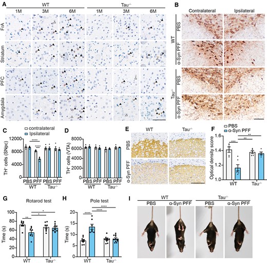 Deletion of tau attenuates the propagation of α-syn pathology in vivo. (A) Representative images of α-syn pathology in wild-type (WT) and tau−/− mice injected with α-syn PFFs at 1, 3 and 6 mpi. Arrowheads indicate Lewy bodies and open arrowheads indicate Lewy neuritis revealed by immunostaining with pS129 antibody. Scale bar = 20 μm (n = 5–10 mice per group). (B) Representative TH staining of SN dopaminergic neurons in wild-type and Tau−/− mice 6 mpi. Scale bar = 20 μm. (C and D) Dopaminergic neuron counting in contralateral and ipsilateral SNpc (C) and VTA (D). (E) Representative TH staining of the ipsilateral striatum. Scale bar = 200 μm. (F) Quantitation of the average optical densities of dopaminergic terminals. (G and H) Rotarod test (G) and pole test (H) were performed 6 mpi in wild-type mice and tau−/− mice. (I) Representative images of tail suspension test presenting clasping arms and legs of wild-type mice and tau−/− mice 6 mpi. Data are presented as mean ± SEM. P-values were determined by two-way ANOVA followed by LSD multiple comparisons. *P < 0.05, **P < 0.01, ***P 0.001, ****P < 0.0001.