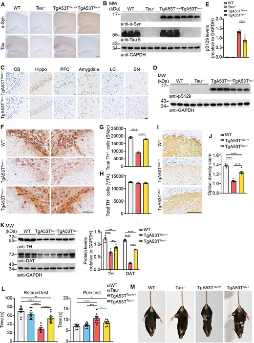 Deletion of tau ameliorates α-syn pathology in TgA53T mouse. (A) Representative immunohistochemistry images showing the expression of α-syn and tau in TgA53TTau+/+ and TgA53TTau−/− mice. Scale bar = 200 μm (n = 5–9 mice per group). (B) Western blot showing the level of α-syn and tau in wild-type (WT), tau−/−, TgA53TTau+/+ and TgA53TTau−/− mice. (C) Immunohistochemistry showing α-syn pathology in TgA53TTau+/+ and TgA53TTau−/− mice by using anti-pS129 antibody. Scale bar = 20 μm. (D) Western blot showing the levels of pS129 in TgA53TTau−/− mice and TgA53TTau+/+ littermates. (E) Quantitation of the levels of pS129. (F) Representative TH staining of SN dopaminergic neurons in wild-type, TgA53TTau+/+ and TgA53TTau−/− mice. (G and H) Dopaminergic neuron counting of total TH+ cells in SNpc (G) and VTA (H). Scale bar = 20 μm. (I) TH immunostaining of the striatum. Scale bar = 200 μm. (J) Quantitation of the optical density of dopaminergic terminals in the striatum. (K) Western blots showing the levels of TH and DAT in the striatum of TgA53TTau+/+ and TgA53TTau−/− mice. Right: Quantitation of the protein levels of TH and DAT. (L) Rotarod test and pole test were performed in wild-type, Tau−/−, TgA53TTau+/+ and TgA53TTau−/− mice. (M) Representative images of tail suspension test showing clasping arms and legs of wild-type, Tau−/−, TgA53TTau+/+ and TgA53TTau−/− mice. Data are presented as mean ± SEM. P-values were determined by one-way ANOVA followed by LSD multiple comparisons. *P < 0.05, **P < 0.01, ***P < 0.001, ****P < 0.0001.