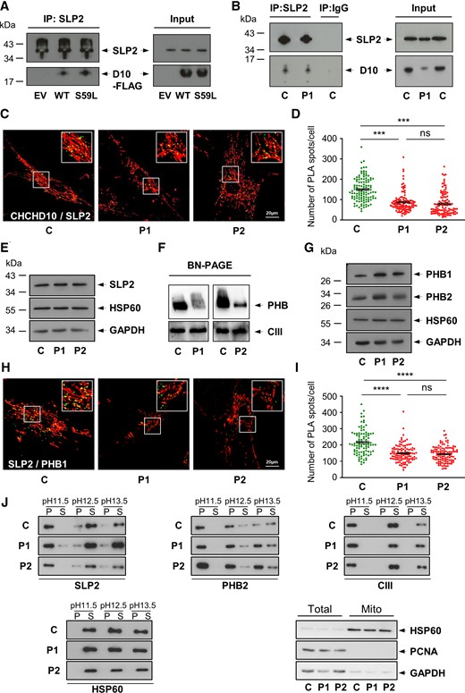 CHCHD10 physically interacts with SLP2 and is involved in the stability of the PHB complex. (A) Co-immunoprecipitation (IP) experiment in HeLa cells, transfected with an empty vector (EV), WT CHCHD10-Flag (WT) or mutant CHCHD10S59L-Flag (S59L) constructs, with an antibody against SLP2 revealed with an anti-FLAG antibody. (B) Co-IP of endogenous CHCHD10 and SLP2 in control (C) and patient (P1) fibroblasts. P1 corresponds to patient V-10 harbouring the p.Ser59Leu variant (CHCHD10S59L/+).1 (C) Duolink PLA between SLP2 and CHCHD10 in control (C) and patient (P1, P2) fibroblasts observed by confocal microscopy. Mitochondria were stained with MitoTracker. P2 corresponds to patient IV-3 (CHCHD10S59L/+).12 Scale bar = 20 µm. (D) Duolink spots per cell were quantified for 30–40 randomly selected individual cells per each studied fibroblast cell line from three independent experiments. Values are mean ± SEM. (E) Western blot on control (C) and patient (P1, P2) fibroblast extracts using antibodies against SLP2, HSP60 or GAPDH. (F) BN-PAGE analysis of mitochondria from control and patient (P1, P2) fibroblasts incubated with an anti-PHB2 antibody. Loading control was performed with an antibody against UQCRC2 (Complex III, CIII). (G) Western blot on control (C) and patient (P1, P2) fibroblast extracts using antibodies against PHB1, PHB2, HSP60 or GAPDH. (H) Duolink PLA between SLP2 and PHB1 in control (C) and patient (P1, P2) fibroblasts observed by confocal microscopy. Mitochondria were stained with MitoTracker. Scale bar = 20 µm. (I) Duolink spots per cell were quantified for 30–35 randomly selected individual cells per each studied fibroblast cell line from three independent experiments. Values are mean ± SEM. (J) Mitochondrial membranes were extracted from control (C) and patient (P1, P2) fibroblasts at the indicated pHs and separated into pellet (P) and supernatant (S) fractions by centrifugation. Fractions were analysed by SDS-PAGE and immunoblotting with antibodies against SLP2, PHB2, UQCRC2 (Complex III, CIII) and HSP60. To verify the purity of isolated mitochondria, total lysates (Total) and mitochondrial isolates (Mito) were analysed by immunoblotting using antibodies against HSP60 (mitochondrial protein), PCNA (nuclear protein) or GAPDH (cytosolic protein).