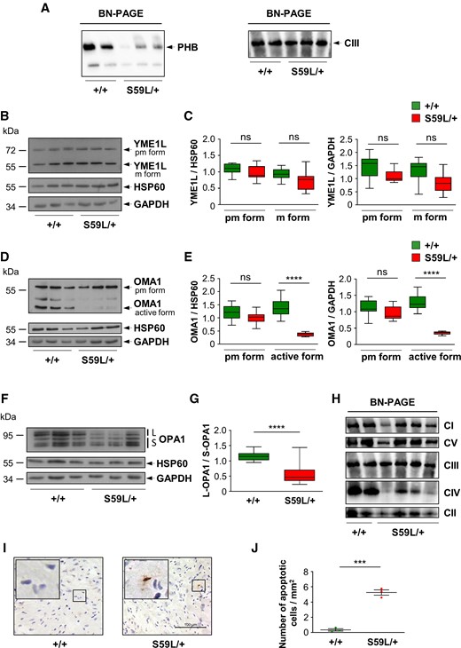 PHB complex disruption, OMA1 activation and increased OPA1 processing in hearts of Chchd10S59L/+ mice. (A) BN-PAGE analysis of heart homogenates from Chchd10S59L/+ mice (S59L/+) and control littermates (+/+) performed with an anti-PHB2 antibody. Loading control was performed with an antibody against UQCRC2 (Complex III CIII). (B) Expression level of YME1L protein analysed by western blotting in heart tissue from Chchd10S59L/+ mice (S59L/+) and control littermates (+/+). The premature (pm, 75 kDa) and mature (m, 63 kDa) forms of YME1L are indicated. Antibodies against HSP60 and GAPDH were used for loading control. (C) Quantification performed from three independent experiments with three Chchd10S59L/+ mice and three control littermates. (D) Representative western blot of OMA1 protein performed with heart lysates from Chchd10S59L/+ mice (S59L/+) and control littermates (+/+). The premature (pm, 60 kDa) and active (47 kDa) forms of OMA1 are indicated. Antibodies against HSP60 and GAPDH were used for loading control. (E) Quantification performed from three independent experiments with three Chchd10S59L/+ mice and three control littermates. (F) Expression level of L-OPA1 forms (L: the two highest bands) and S-OPA1 (S: the three lowest bands) analysed by western blotting in heart tissues from Chchd10S59L/+ mice (S59L/+) and control littermates (+/+). (G) Quantification (from four independent experiments with three Chchd10S59L/+ mice and three control littermates) of L-OPA1/S-OPA1 ratios. (H) BN-PAGE analysis of heart homogenates from Chchd10S59L/+ mice (S59L/+) and control littermates (+/+) performed with antibodies against GRIM19 (complex I, CI), SDHA (complex II, CII), UQCRC2 (complex III, CIII), MTCO2 (complex IV, CIV) and ATBP (complex V, CV) (three independent experiments). (I) TUNEL staining of heart sections from Chchd10S59L/+ mice (S59L/+) and control littermates (+/+). Scale bar = 100 µm. (J) Quantification of TUNEL-positive cells observed in I. Values are mean ± SEM from three independent experiments performed with three Chchd10S59L/+ mice and three control littermates. For each animal, 40–68 visual fields were randomly selected to quantify the number of apoptotic cells.