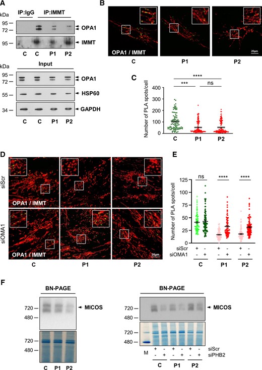 PHB complex stability controls MICOS complex maintenance. (A) Co-immunoprecipitation (IP) of endogenous mitofilin (IMMT) and OPA1 in control (C) and patient (P1, P2) fibroblasts. (B) Duolink PLA between IMMT and OPA1 in control (C) and patient (P1, P2) fibroblasts observed by confocal microscopy. Mitochondria were stained with MitoTracker. Scale bar = 20 µm. (C) Duolink spots per cell were quantified for 30–40 randomly selected individual cells per each studied fibroblast cell line from three independent experiments. Values are mean ± SEM. (D) Control (C) or patient (P1, P2) fibroblasts were transfected with scrambled siRNA (siScr), as a negative control, or OMA1 siRNA (siOMA1). Duolink PLA between IMMT and OPA1 in control (C) and patient (P1, P2) fibroblasts, transfected with siScr or siOMA1, observed by confocal microscopy. Mitochondria were stained with MitoTracker. Scale bar = 20 µm. (E) Duolink spots per cell were quantified for 20–30 randomly selected individual cells per each studied fibroblast cell line from three independent experiments. Values are mean ± SEM. (F) BN-PAGE analysis showing MICOS state in basal conditions (left) or 72 h post-transfection with scrambled siRNA (siScr), as a negative control or PHB2 siRNA (siPHB2) (right) in control (C) and patient (P1, P2) fibroblasts. Mitochondrial proteins from fibroblasts were analysed by BN-PAGE with an anti-mitofilin antibody. Gels were stained with Coomassie brilliant blue as loading control (three independent experiments). M = NativeMark™ unstained protein standard.