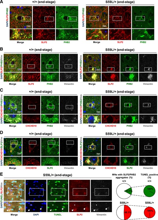SLP2/PHB2 aggregates with increased cell death in spinal motor neurons of Chchd10S59L/+ mice. (A) Immunolabelling with antibodies against SLP2 and PHB2 in MNs on lumbar spinal cord sections from Chchd10S59L/+ mice (S59L/+) and control littermates (+/+) at end-stage. Scale bar = 10 µm. (B) Lumbar spinal cord sections visualizing spinal MNs from Chchd10S59L/+ mice (S59L/+) and control littermates (+/+) at end-stage, immunolabelled with antibodies against SLP2, PHB2 and Vimentin. Scale bar = 10 µm. (C) Lumbar spinal cord sections from Chchd10S59L/+ mice (S59L/+) and control littermates (+/+) at end-stage. Immunolabelling was performed with antibodies against CHCHD10, PHB2 and Vimentin. Scale bar = 10 µm. (D) Lumbar spinal cord sections from Chchd10S59L/+ mice (S59L/+) and control littermates (+/+) at end-stage, immunolabelled with antibodies against CHCHD10, SLP2 and Vimentin. Scale bar = 10 µm. (E) Lumbar spinal cord sections from Chchd10S59L/+ mice (S59L/+) at end-stage. Left, TUNEL assay was combined with immunolabelling by using antibodies against SLP2 and Vimentin. Arrows indicate apoptotic (TUNEL+/DAPI+/SLP2+/Vimentin+) neurons. Asterix indicates a DAPI+/TUNEL−/SLP2−/Vimentin− neuron. Right, Quantification of SLP2+/Vimentin+ neurons (Supplementary Fig. 6C) displaying TUNEL-positive signal. n = 3 independent experiments from three Chchd10S59L/+ mice and three control littermates. A total of 96–103 SLP2+/Vimentin+ MNs from S59L/+ mice or control littermates was analysed. Scale bar = 20 µm.