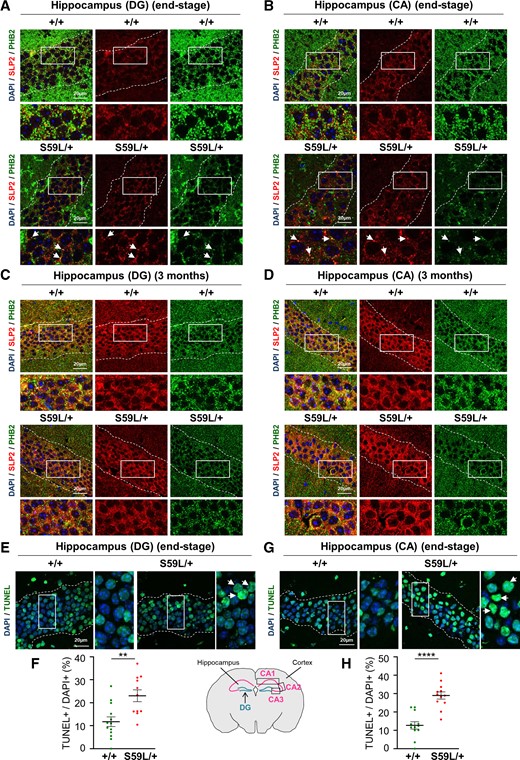 SLP2/PHB2 aggregates and increased apoptosis in the hippocampus of Chchd10S59L/+ mice. (A and B) Brain sections visualizing hippocampal areas: dentate gyrus (DG) (A) and cornus ammonis (CA) (B) delimited by dotted lines, from Chchd10S59L/+ mice (S59L/+) and control littermates (+/+) at end-stage. Immunolabelling was performed with antibodies against SLP2 and PHB2. Arrows indicate SLP2/PHB2 colocalized puncta. Scale bar = 20 µm. (C and D) Sections of hippocampal areas: DG (C) and CA (D), delimited by dotted lines, from Chchd10S59L/+ mice (S59L/+) and control littermates (+/+) at 3 months of age, immunolabelled with antibodies against SLP2 and PHB2. Scale bar = 20 µm. (E and G) TUNEL staining of brain sections from Chchd10S59L/+ mice (S59L/+) and control littermates (+/+) visualizing DG (E) and CA (G) delimited by dotted lines. Arrows indicate apoptotic (TUNEL+/DAPI+) cells. Scale bar = 20 µm. (F and H) Quantification of TUNEL-positive cells observed in E and G, respectively. n = 3 independent experiments with three Chchd10S59L/+ mice and three control littermates. For each animal, four fields (five images per field) from DG or CA1 to CA3 were randomly selected and analysed for scoring TUNEL-positive cells versus total number of nuclei. Values are mean ± SEM.