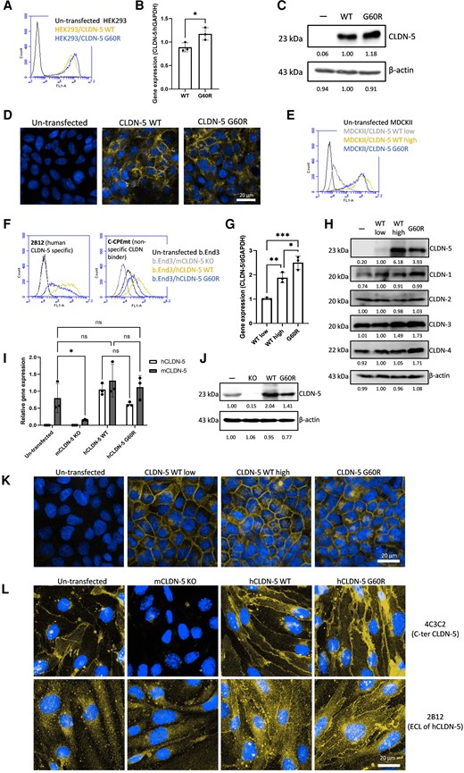 The effect of G60R mutation on CLDN-5 expression and localization in CLDN-null cells. Stable transfectants of HEK293 cells (CLDN-null cells) (A–D), MDCKII cells (CLDN-competent cells) (E, G, H and K) or b.End3 cells (mouse brain endothelial cell line) (F, I, J and L) expressing CLDN-5 wild-type (WT) or G60R were established. (A, E and F) Cell-surface expression of CLDN-5 in HEK293, MDCKII and b.End3 transfectants respectively was analysed using an antibody recognizing the extracellular domain of CLDN-5 or non-specific CLDN-binding molecule (C-CPEmt). (C, G and I) The transcript levels of claudin-5 and (D, H and J) protein levels of CLDN-5 and other major CLDNs in transfectants. (B, K and L) Subcellular localization of CLDN-5 in transfectants was checked by confocal microscopy. Green = CLDN-5, blue = nuclei. Scale bar = 20 μm.