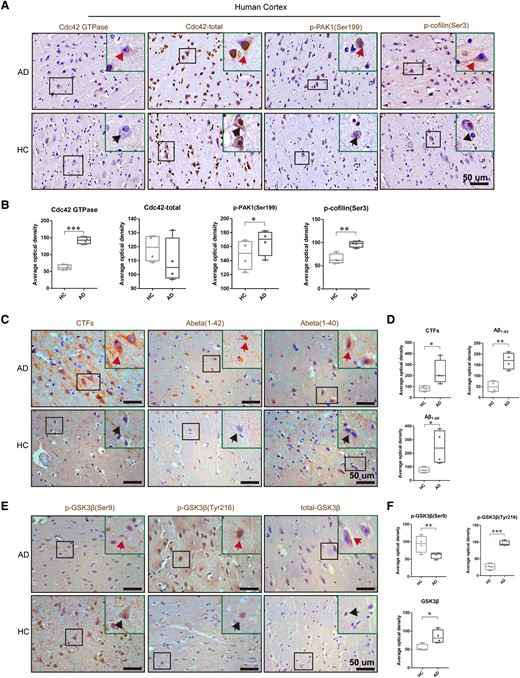 The Cdc42 pathway and GSK-3β activity were activated in the cortex of patients with AD. (A and B) Representative immunohistochemical staining images showed unaltered total Cdc42 and elevated Cdc42 activity, the phosphorylated form of PAK and cofilin in the cortex of AD patients (n = 4). Arrows point to representative cells. (C and D) Representative immunohistochemical staining images showed increased CTFs, Aβ1–42 and Aβ1–40 in the cortex of AD patients. Arrows point to representative cells. (E and F) Representative immunohistochemical staining images showed increased activity of GSK-3β and total GSK-3β. Arrows point to representative cells. Samples were from four patients with AD and four healthy control subjects (HC). One-way ANOVA was used across groups, and the least significant difference test was used for post hoc comparison. Error bars depict SEM. *P < 0.05, **P < 0.01, ***P < 0.001.