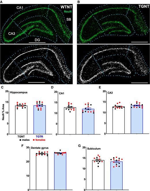 Effect of IBU on hippocampal neuronal density. (A) WTNT rats had significantly higher neuronal density (NeuN staining) in the DG area compared to (B) TGNT rats, P < 0.0001. Corresponding masks are shown in A and B. Analysis of neuronal density between TGNT and TGTR rats showed no significant difference in (C) the hippocampus collapsed across all subregions, (D) CA1, (E) CA3, (F) DG and (G) SB. Scale bar = 1000 µm. Unpaired one-tail t-tests with Welch’s corrections were used in C–G. n = 12 TGNT, n = 14 TGTR. *P < 0.05.