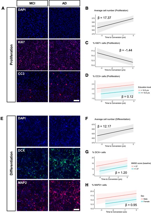 Exposure to 1% serum from MCI converters leads to decreased proliferation, increased cell death and increased neurogenesis. (A) Representative images of proliferation phase cells treated with serum from the same individual. Left (MCI panel): serum sample from 1 year before conversion. Right (AD panel): serum sample taken at the time of conversion to Alzheimer’s disease (AD). Nuclei are stained with DAPI. Ki67 and CC3 were used to label proliferating and apoptotic cells, respectively. (B–D) Modelled trajectories (with 95% CIs) of linear mixed-effects regression models fitted to the proliferation phase data. Time of conversion to Alzheimer’s disease was assigned 0, and the number of years before conversion were assigned negative values (i.e. 1 year before conversion is −1). Longitudinal serum samples from MCI converters increased average cell number (B), decreased proliferation (% Ki67+) (C) and increased apoptotic cell death (% CC3+) (D). Slopes (β coefficient estimates) are indicated within the plots. (E) Representative images of differentiation phase cells treated with serum from the same individual. Left (MCI panel): serum sample from 1 year before conversion. Right (AD panel): serum sample taken at the time of conversion to AD. Nuclei are stained with DAPI. DCX and MAP2 were used to label neuroblasts and mature neurons, respectively. (F–H) Modelled trajectories (with 95% CIs) of linear mixed-effects regression models fitted to the differentiation phase data. Time of conversion to Alzheimer’s disease was assigned 0, and the number of years before conversion were assigned negative values (i.e. 1 year before conversion is −1). Longitudinal serum samples from MCI converters increased average cell number (F), neuroblasts (% DCX+) (G) and mature neurons (% MAP2+) (H). Slopes (β coefficient estimates) are indicated within the plots. Scale bar = 100 μm.