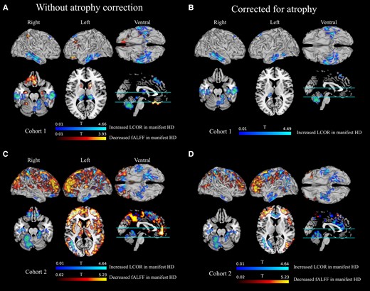 Voxel-wise fALFF and LCOR contrasts of patients with Huntington’s disease relative to their respective healthy controls. In a number of clusters where fALFF was significantly reduced in manifest Huntington’s disease of the first (A and B) or second (C and D) cohort, and LCOR significantly higher in manifest Huntington’s disease. Left panels: the atrophy-uncorrected contrasts; right panels: the atrophy-corrected contrasts. Anatomical regions covered by clusters and the MNI coordinates of the voxel with the peak t-value are listed in Supplementary Tables 2 and 3.