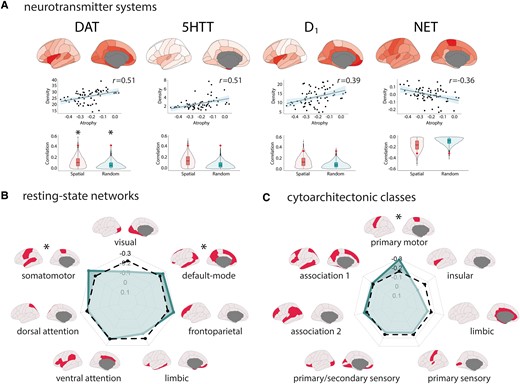 Cortical thinning in iRBD map onto specific regional tracer density, resting-state networks, and cytoarchitectonic classes. (A) Brain renderings and scatterplots showing the tracer density maps of the receptors, transporters, and binding sites associated with cortical thickness W-scores in iRBD. The violin plots show the empirical correlations tested against distributions of correlations from sets of spatial and random null models. The asterisk indicates the significant associations after Bonferroni correction. Radar charts showing the correlation between cortical thickness W-scores in iRBD and (B) resting-state networks and (C) cytoarchitectonic classes. The regular line represents the empirical correlations, and the dashed line represents the average correlation observed in sets of 10 000 spatial null models. The asterisk indicates the networks and classes where the observed spatial correlation was significantly different from the null correlation.