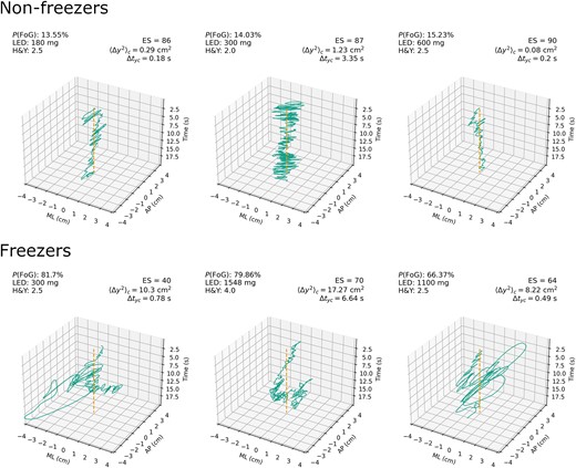 Raw stabilogram plots for sensory organization test 4 (SOT4) by group. Group membership, logistic LASSO model probability of FoG, LED, equilibrium score, critical mean square displacement in anterior-posterior axis on SOT4, and critical time interval in anterior-posterior axis on SOT4. The top row represents three participants least likely to have FoG based on logistic LASSO regression model predictions (true negatives). The bottom row represents three participants most likely to have FoG based on model predictions (true positives). Dashed line in the centre represents mean of COP point distribution, which gives a reference frame for examining sway around the base of support. ⟨Δy2⟩c = critical mean square displacement in y anterior-posterior axis; Δtyc = critical time interval in anterior-posterior axis; P(FoG) = model-predicted probability of FoG status. AP = anterior-posterior; ES = NeuroCom© Equitest equilibrium score; H&Y = Hoehn and Yahr (clinical postural stability score); LED = levodopa-equivalent dose; ML = medio-lateral .