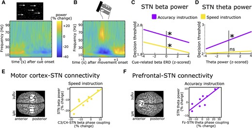 Recordings of subthalamic activity. (A) Time-frequency spectrum of subthalamic nucleus (STN) recordings (group-level) aligned to the onset of a moving dots-cue. (B) Same as in A but aligned to onset of movement (force grip). (C) Stronger cue-induced reductions in STN beta power are predictive of lower decision thresholds irrespective of instructions. (D) Increases in STN theta power during deliberation are predictive of higher decision thresholds after Accuracy (purple) but not Speed instructions (yellow). (E) Phase coupling between electrode C3/C4 (covering motor cortex) and STN in the beta band correlates with STN beta power during Speed (yellow) but not Accuracy instructions (not shown). (F) Phase coupling between electrode Fz (covering medial prefrontal cortex) and STN in the theta band correlates with STN theta power during Accuracy (purple) but not Speed instructions (not shown). A and B are based on Herz et al.73C–F are based on Herz et al.69
