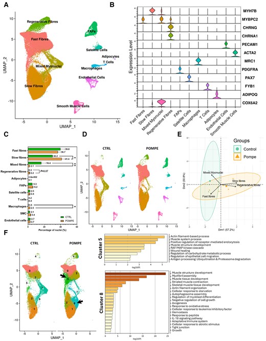 Repartition of cell types in control and Pompe muscle samples. (A) UMAP visualization of all the nuclei from control and Pompe samples coloured by cell identity. Control, n = 4; Pompe, n = 8. (B) Violin plots showing the expression of selected marker genes for each cluster of nuclei. (C) Percentage of nuclei for each cell population between control and Pompe samples. Control, n = 4; Pompe, n = 8. Mann–Whitney U-test; *P < 0.05 and **P < 0.01. (D) UMAP showing clusters identified in control (left) and Pompe (right) samples coloured by cell identity. Control, n = 4; Pompe, n = 8. (E) Principal component analysis showing the distribution of individuals based on the proportion each population of myonuclei. (F) Left: UMAP showing only the myofibre clusters, before assigning identity in A, in control and Pompe disease samples. Clusters 5 and 8 (fast and slow fibres, respectively) appear in Pompe samples. Right: Metascape analysis of the most expressed genes in Clusters 5 and 8. Only genes upregulated with a log2 fold change of >0.5 were analysed. Control, n = 4; Pompe, n = 8. FAPs = fibro-adipogenic progenitor cells; UMAP = uniform manifold approximation and projection.