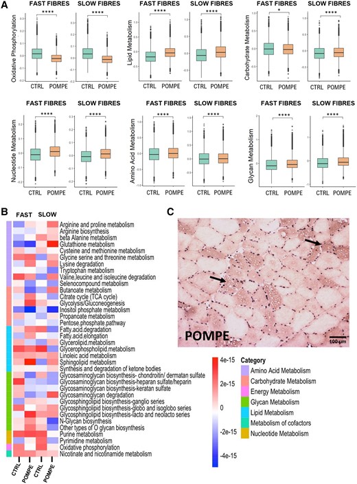 Metabolic changes observed between control and Pompe muscle samples. (A) Box plot of different metabolic scores in slow and fast fibres between control and Pompe muscle samples. Control, n = 4; Pompe, n = 8. Wilcoxon test; *P < 0.05 and ****P < 0.0001. (B) Heat map displaying Z-scores of metabolic pathway activity in slow and fast fibres from control and Pompe muscle samples. Each row represents a specific metabolic pathway. The colour scale reflects the level of pathway activity, with warmer colours indicating higher activity and cooler colours denoting lower activity. Control, n = 4; Pompe, n = 8. (C) Oil Red staining of Pompe disease muscle; arrows indicate lipid accumulation. UMAP = uniform manifold approximation and projection.