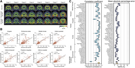FDG-PET based tau-PET synthesis results. (A) Eight representative cases with original FDG-PET, ground-truth tau-PET and artificial intelligence (AI)-imputed tau PET. (B) Scatter plots of ground-truth tau-PET and AI-imputed tau PET from seven representative regions of interest (ROIs) and meta-ROI. r indicates Pearson’s correlation coefficient. MAPE = mean absolute percentage error. Linear regression (black line) and 95% confidence bands (dotted lines) are shown. (C) The mean of correlation coefficient and MAPE of five folds from 46 ROIs and the meta-ROI is summarized in a box plot. The yellow-coloured box depicts the meta-ROI result. Open circles indicate different folds. SUVR = standardized uptake value ratio.