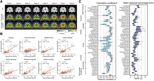 Structural MRI-based tau-PET synthesis results. (A) Eight representative cases with original T1-weighted (T1w), ground-truth tau-PET and artificial intelligence (AI)-imputed tau-PET. (B) Scatter plots between ground-truth tau-PET and AI-imputed tau-PET from seven representative regions of interest (ROIs) and meta-ROI. r indicates the Pearson’s correlation coefficient. MAPE = mean absolute percentage error. Linear regression (black line) and 95% confidence bands (dotted lines) are shown. (C) The mean correlation coefficient and MAPE of five folds from 46 ROIs and meta-ROI is summarized in the box plots. The yellow-coloured box depicts the meta-ROI result. Open circles indicate different folds. SUVR = standardized uptake value ratio.