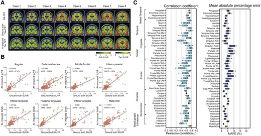 Amyloid-PET based tau-PET synthesis results. (A) Eight representative cases with actual Pittsburgh compound B (PiB)-PET, ground-truth tau-PET and artificial intelligence (AI)-imputed tau PET. (B) Scatter plots between ground-truth tau PET and AI-imputed tau PET from seven representative regions of interest (ROIs) and meta-ROI. r indicates the Pearson’s correlation coefficient. MAPE = mean absolute percentage error. Linear regression (black line) and 95% confidence bands (dotted lines) are shown. (C) The mean of correlation coefficient and MAPE of five folds from 46 ROIs and meta-ROI is summarized in a box plot. The yellow-coloured box depicts the meta-ROI result. Open circles indicate different folds. SUVR = standardized uptake value ratio.