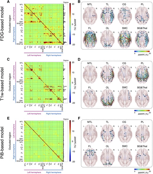 Occlusion analysis. Region of interest (ROI)-wise occlusion analysis was performed to enhance the interpretability of model. (A, C and E) The adjacency matrix shows the ΔMAPE (mean absolute percentage error) in one ROI (horizontal axis) from occluding another ROI (vertical axis) for FDG-, T1W- and PiB-based model, respectively. ΔMAPE was calculated as MAPER1→R2 − MAPER2, where R1 is an occluded ROI and R2 is the region where the MAPE is calculated. The right panel in each matrix indicates the summation of ΔMAPE along the horizontal axis. (B, D and F) 3D rendering plots of the adjacency matrix in A, C and E for FDG-, T1W- and PiB-based model, respectively. Each edge’s colour was illustrated by ΔMAPE value between nodes. Each label denoted above the figure indicate the occluded regions. BG&Thal = basal ganglia and thalamus; CG = cingulate cortex; FL = frontal lobe; MTL = medial temporal lobe; OL = occipital lobe; PL = parietal lobe; SMC = sensorimotor cortex; TL = temporal lobe.