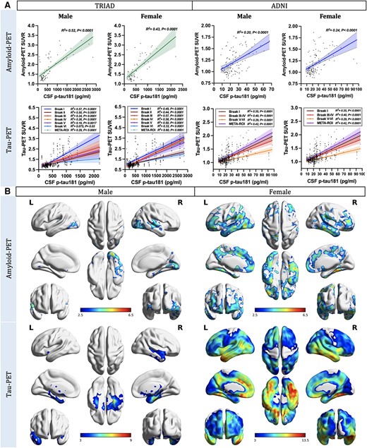 Cortical amyloid-β and tau aggregates strongly correlate with CSF phosphorylated tau181 concentration. (A) Sex-disaggregated linear regression analyses were performed in both TRIAD and ADNI cohorts to elucidate the sex differences in the relationships between CSF phosphorylated tau-181 (p-tau181) concentrations and regional amyloid-β (Aβ) and tau load. Findings revealed that both male and female subjects presented positive correlations between CSF p-tau181 concentration and neocortical Aβ-PET standardized uptake value ratio (SUVR; TRIAD, males: P < 0.0001, R2 = 0.43; females: P < 0.0001, R2 = 0.52. ADNI, males: P < 0.0001, R2 = 0.20; females: P < 0.0001, R2 = 0.24). Furthermore, both male and female individuals displayed positive correlations between CSF p-tau181 concentrations and regional tau-PET SUVRs. It is noteworthy that this positive correlation appeared to weaken or become non-significant in Braak V-VI regions of interest (ROIs) in male subjects (TRIAD, Braak V: P = 0.0017, R2 = 0.16; Braak VI: P = 0.03, R2 = 0.075. ADNI, Braak V-VI: not significant), while female subjects continued to demonstrate moderate positive correlations between CSF p-tau181 concentrations and regional tau-PET SUVRs in subjects (TRIAD, Braak V: P < 0.0001, R2 = 0.5; Braak VI: P < 0.0001, R2 = 0.32. ADNI, Braak V-VI: P < 0.0001, R2 = 0.29). (B) Sex-disaggregated voxel-based analyses were conducted within the TRIAD cohort to explore the differences between sexes in the associations between CSF p-tau181 and cerebral Aβ and tau load at the voxel level. The findings revealed a noteworthy positive correlation between CSF p-tau181 concentration and Aβ-PET signal in the temporoparietal cortices of males. Conversely, in females, this positive correlation was observed in multiple brain regions across the brain. When we investigated the relationships between CSF p-tau181 and tau-PET data, males exhibited a positive connection between CSF p-tau181 concentration and tau-PET signal primarily in the cingulum and temporal cortices. In contrast, females displayed a positive relationship between CSF p-tau181 concentration and tau load throughout the entire brain. Images represent voxel-based t-statistical parametric maps overlaid on the structural MRI reference template. Age, APOE ε4 carriage status and pathological status were used as covariates in the model. Results were corrected for multiple comparisons using a false discovery rate (FDR) cluster threshold of P < 0.001. ADNI = Alzheimer’s Disease Neuroimaging Initiative; L = left; R = right; TRIAD = Translational Biomarkers in Aging and Dementia.